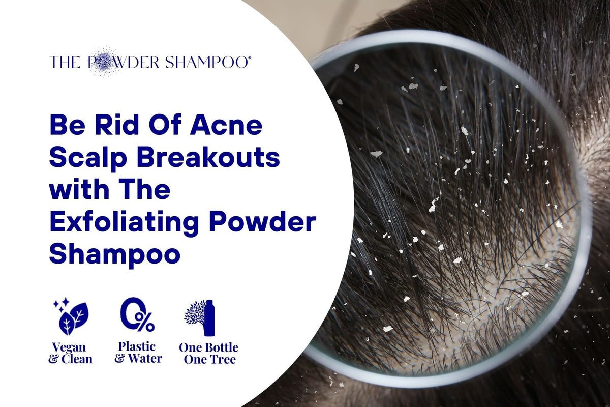 Be Rid Of Acne Scalp Breakouts with The Exfoliating Powder Shampoo