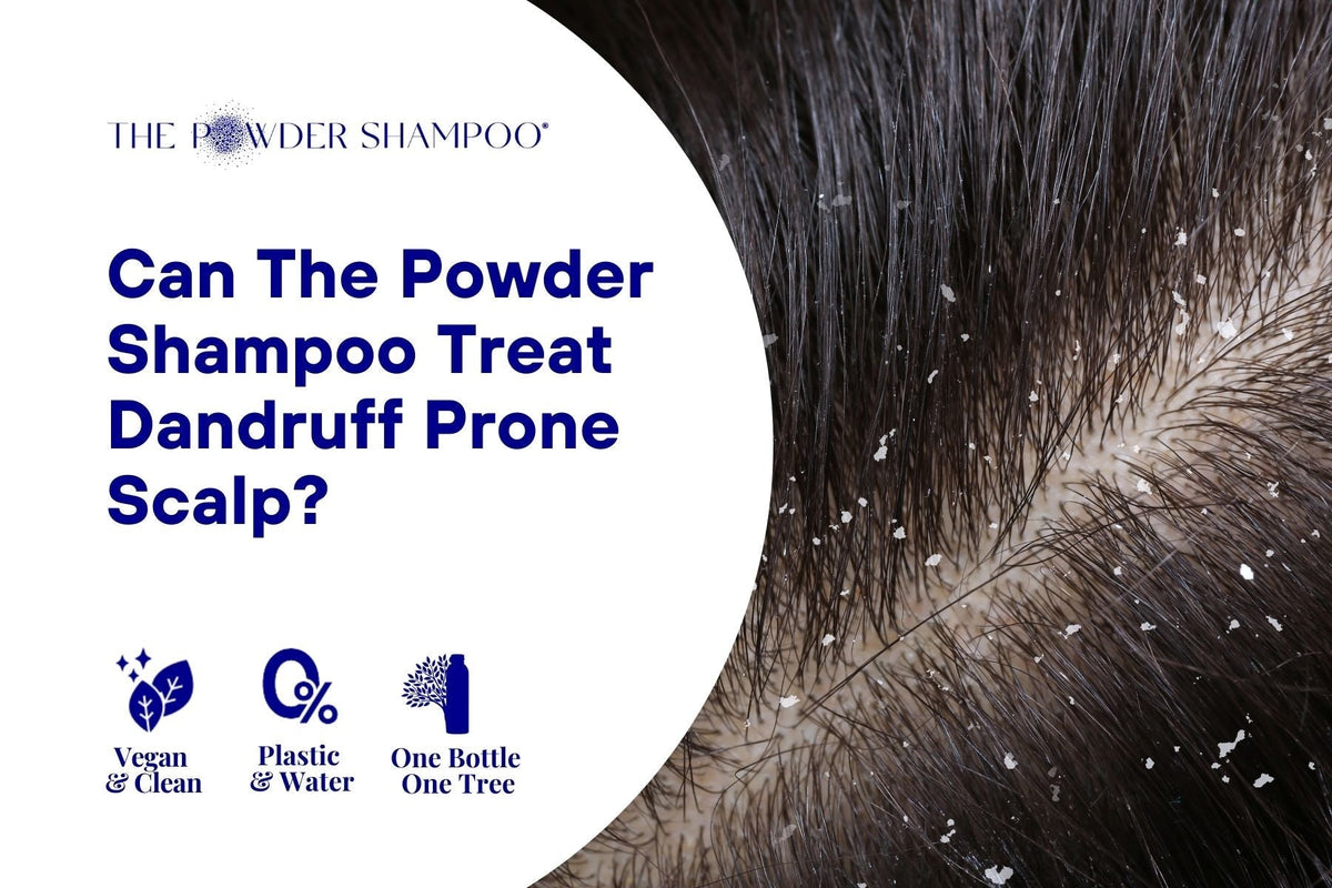 Can The Powder Shampoo Treat Dandruff Prone Scalp?